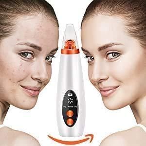 Remove Blackhead Device | USB Rechargeable Facial Skin Cleansing Tool