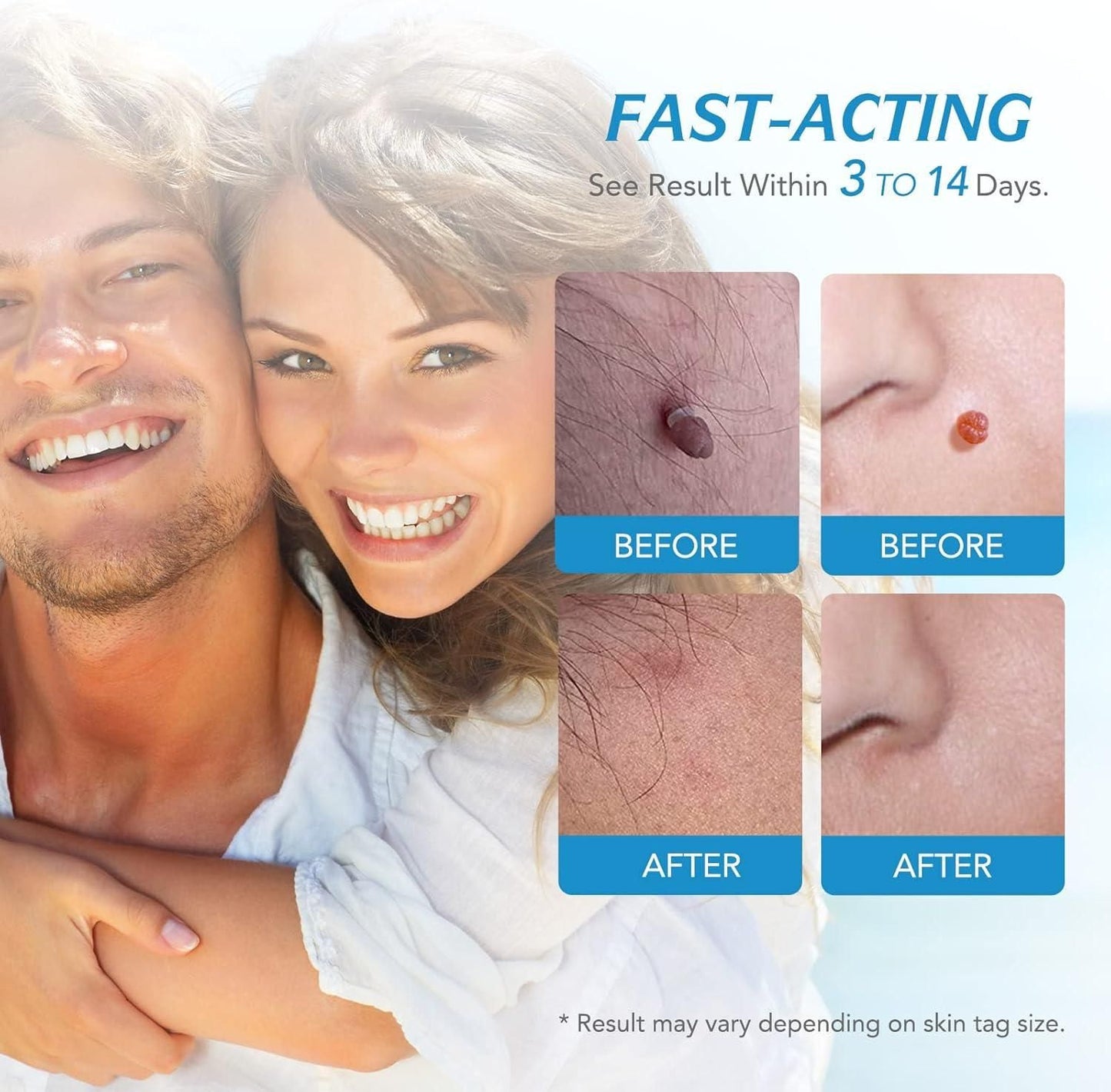 2-in-1 Skin Tag Remover Kit | Painless & Natural Skin Care Tool