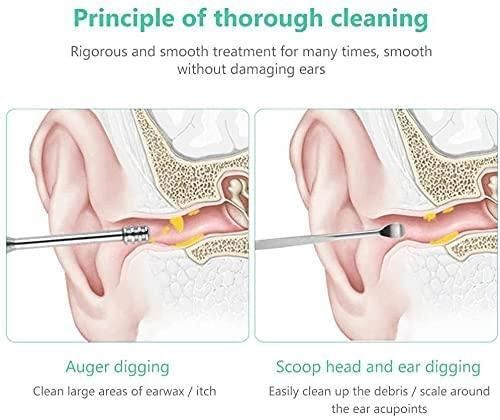 6-Piece Stainless Steel Ear Wax Removal Kit – Professional Ear Care Tools